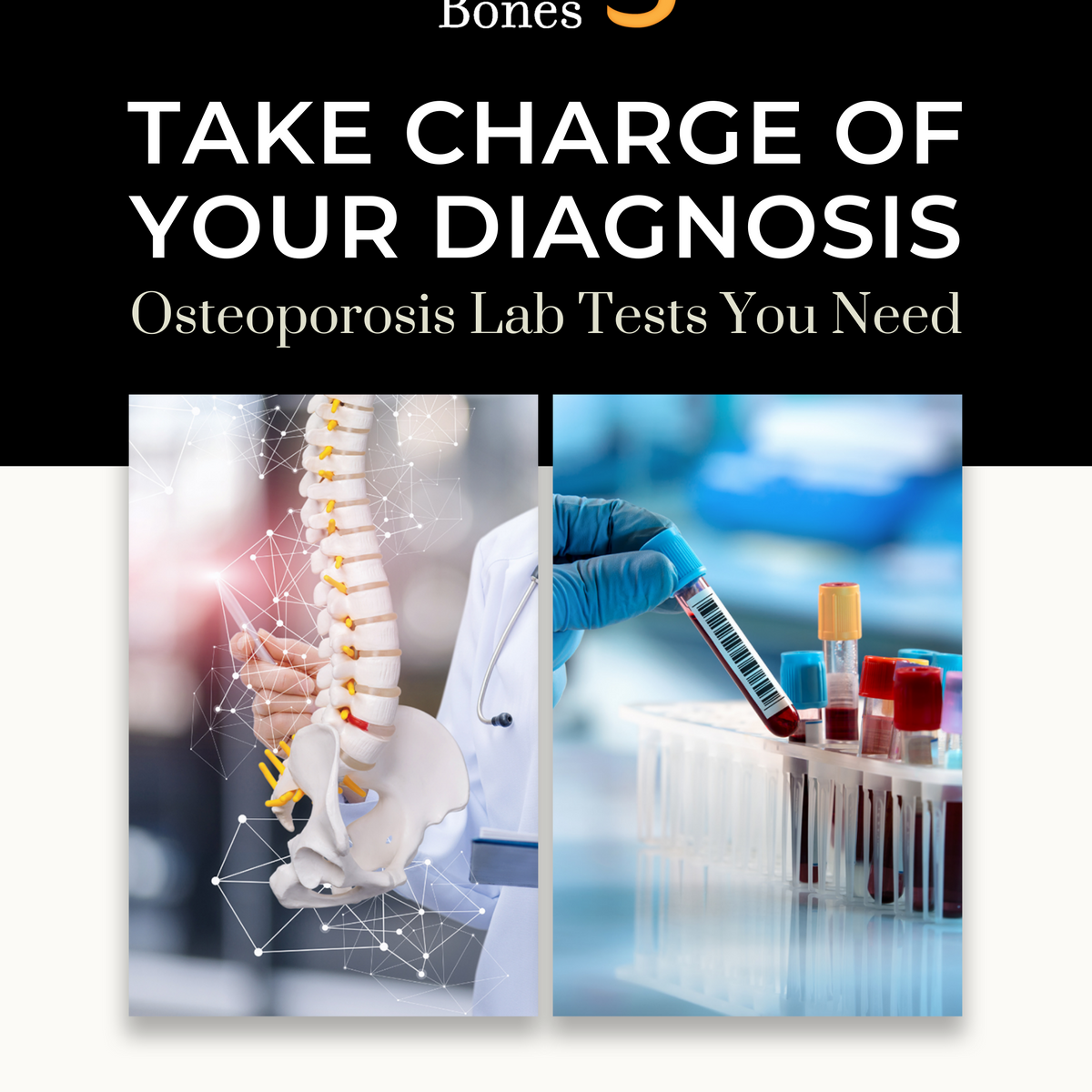 Bone Lab Work Osteo Lab Tests You Need: E-Guide + Online Course — Better Bones ...